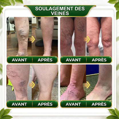 ☘️ GreenFeel® Berberin-Moringa-Bienengift Detox-Schlankheits-Fußbadperlen unterstützen das Gewichtsmanagement, die Lymphdrainage, eine gesunde Durchblutung, das weibliche Wohlbefinden und ein straffer wirkendes Hautbild. 🔥