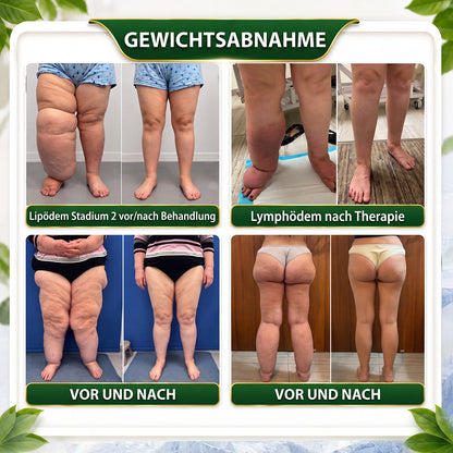 ☘️ GreenFeel® Berberin-Moringa-Bienengift Detox-Schlankheits-Fußbadperlen unterstützen das Gewichtsmanagement, die Lymphdrainage, eine gesunde Durchblutung, das weibliche Wohlbefinden und ein straffer wirkendes Hautbild. 🔥